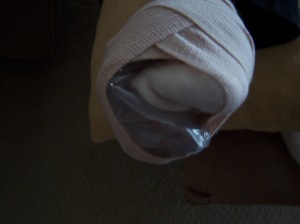 Bandaged Foot with Ice